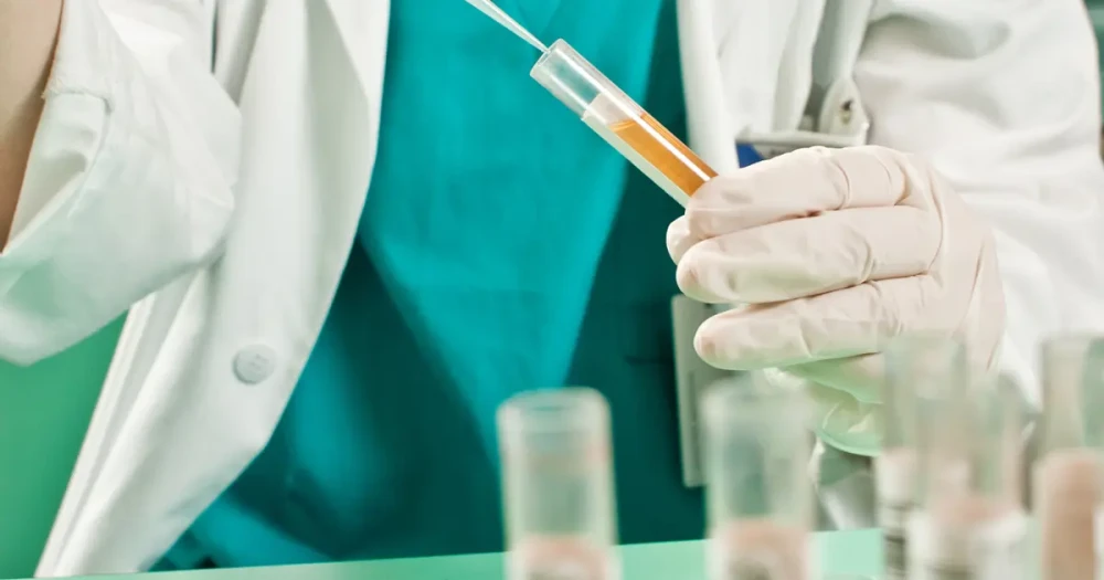 Uyuşturucu Testleri: Efsaneler ve Bilimsel Gerçekler
