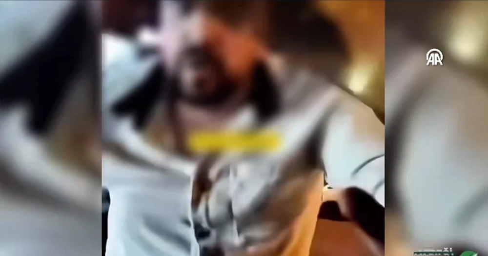 Kafa Atarak Cam Kırdı, Trafiği Tehlikeye Attı: Saldırgan Gözaltında