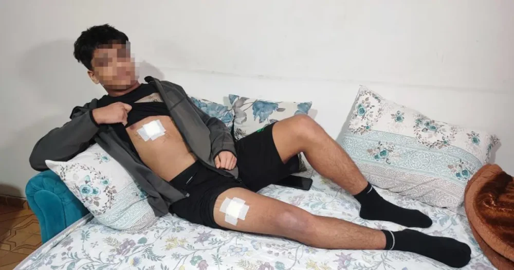 Akran Zorbalığıyla Yüzleşen Genç: 15 Yaşındaki Çocuk, Saldırganlar Tarafından Üç Yerinden Bıçaklandı