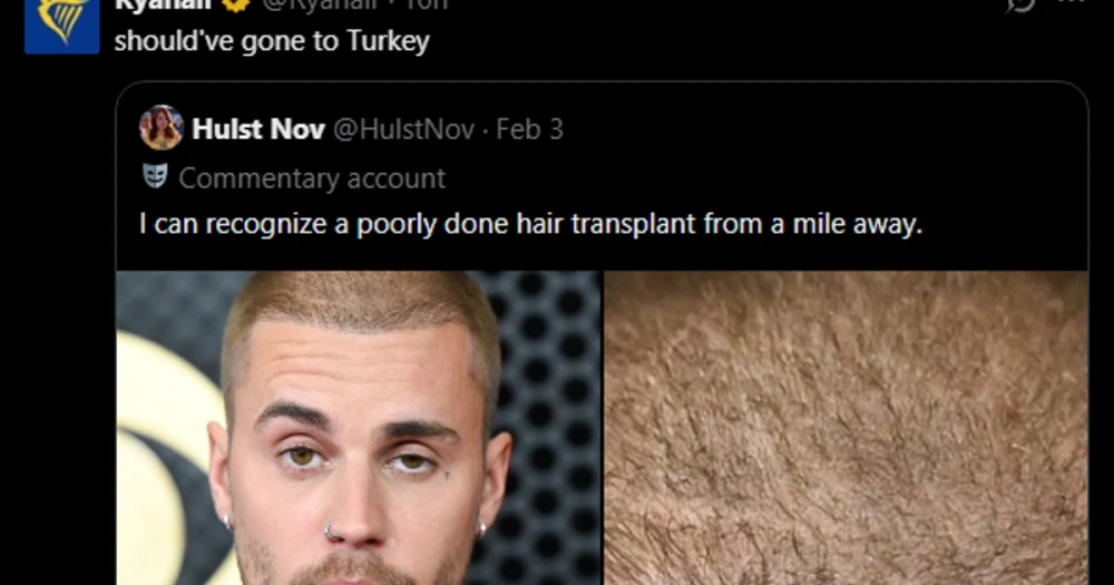 Ryanair'den Justin Bieber'a Saç Ekimi Yorumu: "Türkiye'ye Gitmeliydi"