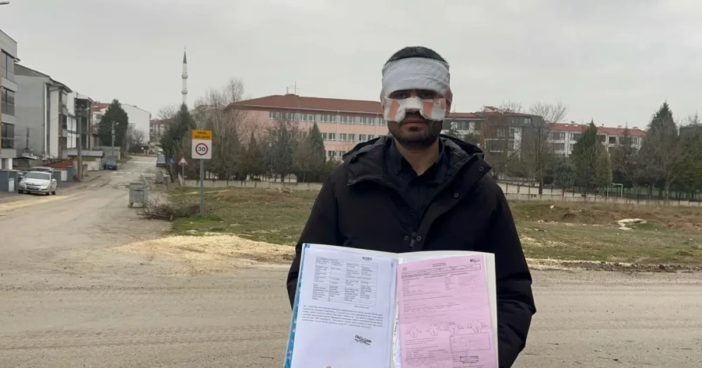 Öğretmen Odasında Sıcak Çay Faciası: Yüzü Yandı