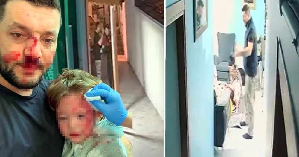 Baba ve 14 Aylık Kızına Yönelik Saldırı Davasında Sanık Tahliye Edildi